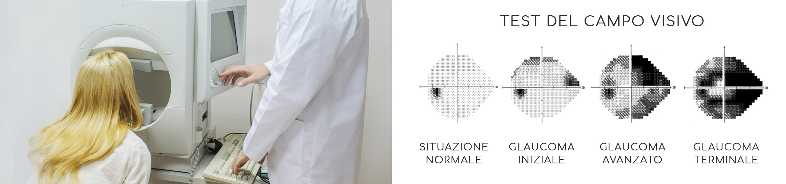 Glaucoma - test del campo visivo! - stileItaliano